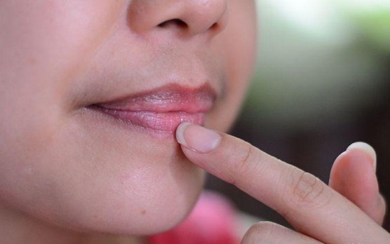 कैसे छुटकारा पाये काले होंठों से How To Get Rid of Black Lips Fast in Hindi
